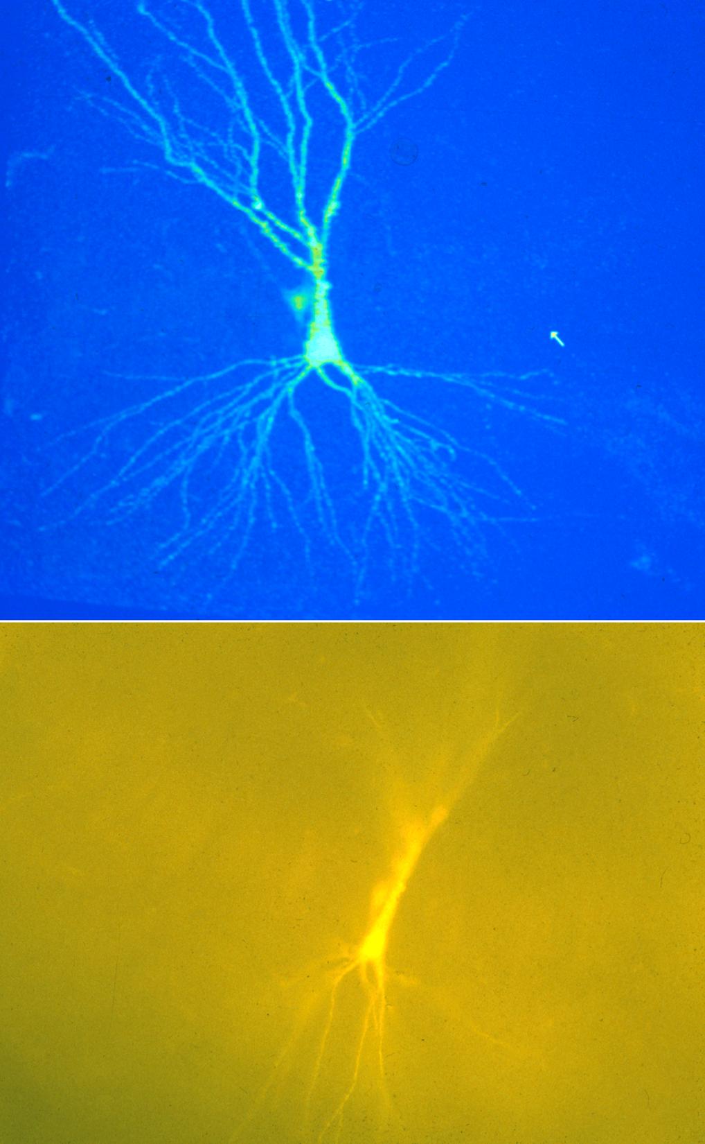 Comparison of bright field and second harmonic generation (SHG) imaging of isolated collagen fibers and mouse skin. Comparison of bright field and second harmonic generation (SHG) imaging of isolated collagen fibers and mouse skin.