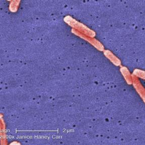 Colorized SEM Legionella. Photo credit: Janice Haney Carr; Content: CDC/Margaret Williams, Claressa Lucas, Tatiana Travis