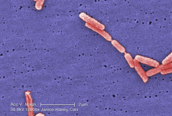 Colorized SEM Legionella. Photo credit: Janice Haney Carr; Content: CDC/Margaret Williams, Claressa Lucas, Tatiana Travis