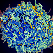 HIV (yellow) attacking T cell. Credit: Seth Pincus, Elizabeth Fischer, Austin Athman, NIAID, NIH