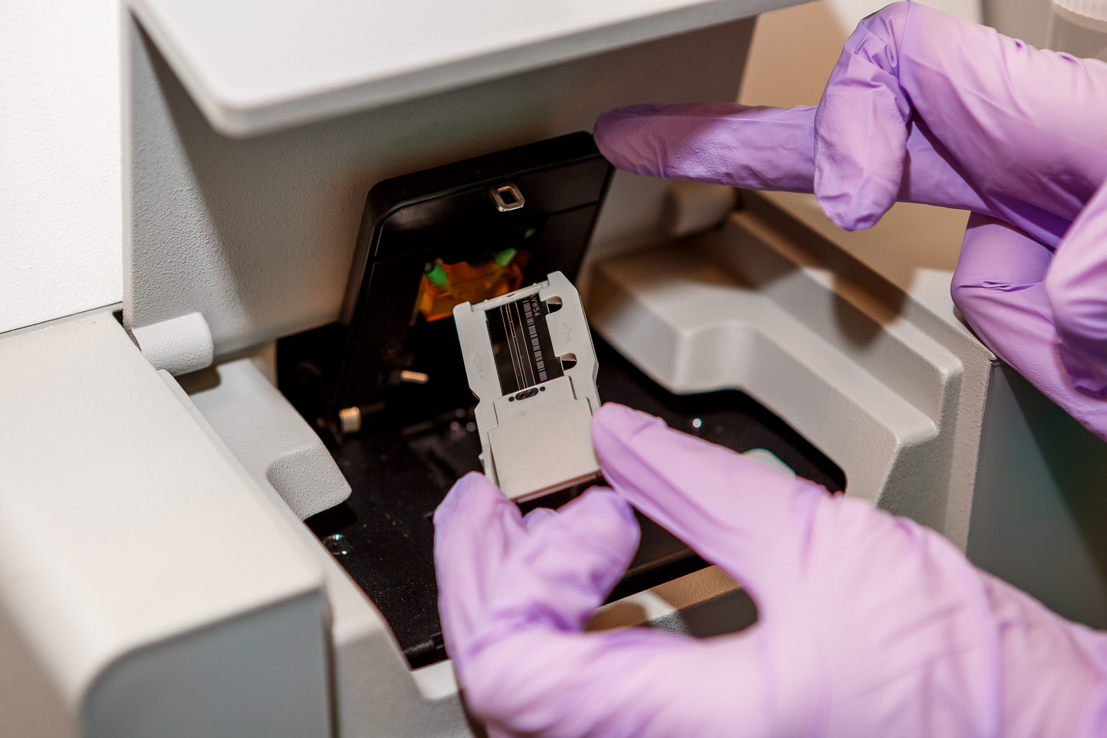 A new screening test for cystic fibrosis will use next generation sequencing.