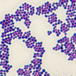 Gram stain of Staphylococcus aureus, a Gram-positive bacterium that is capable of causing human infections.