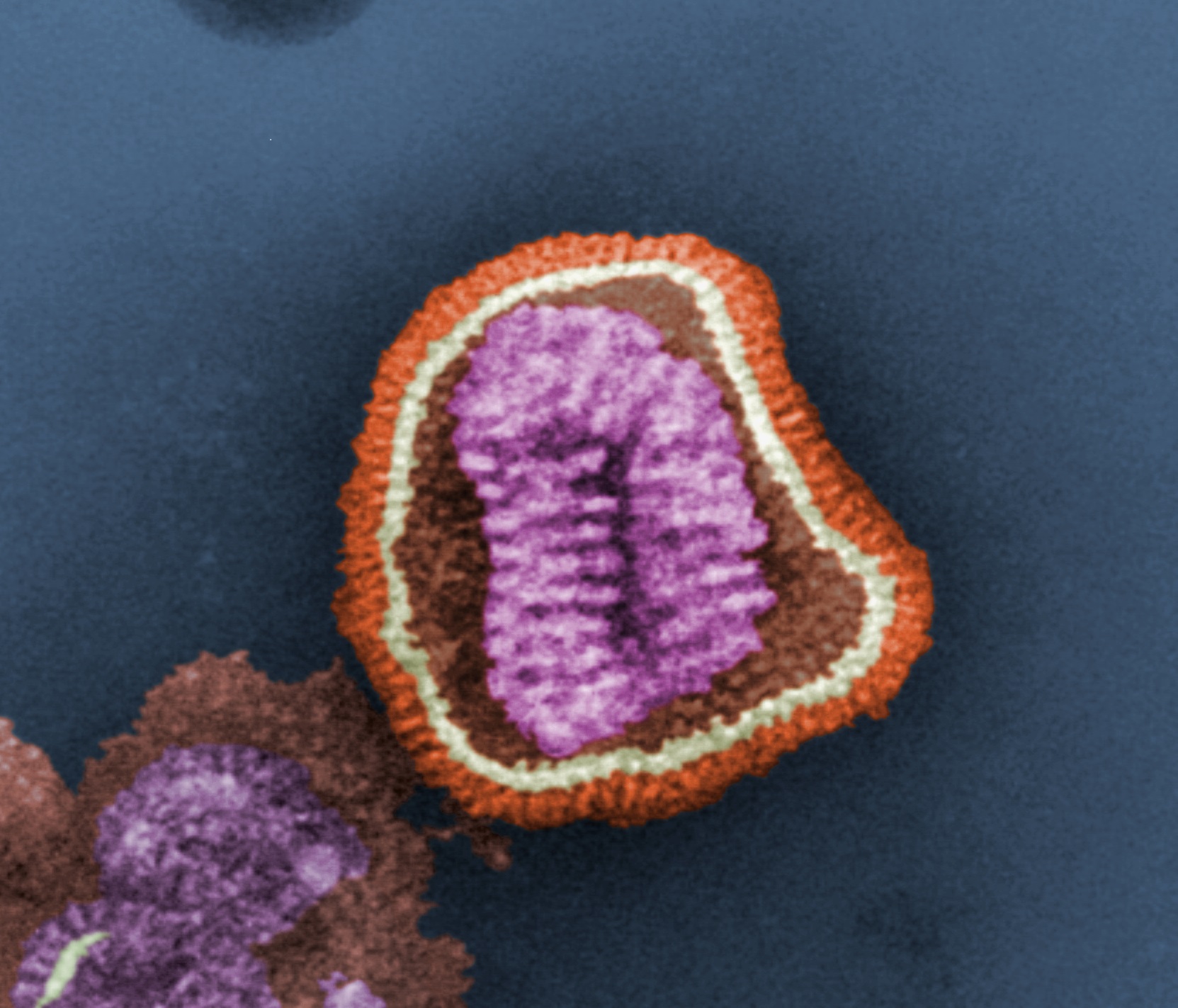 Influenza virus. Photo Credit: Frederick Murphy; Content Provider CDC/Erskine Palmer, Ph.D.; M.L. Martin