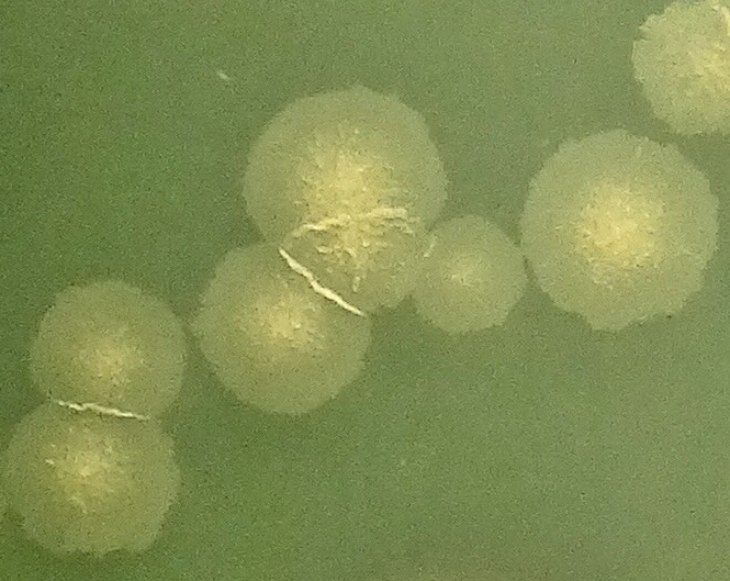 Mycobacterium on agar plate