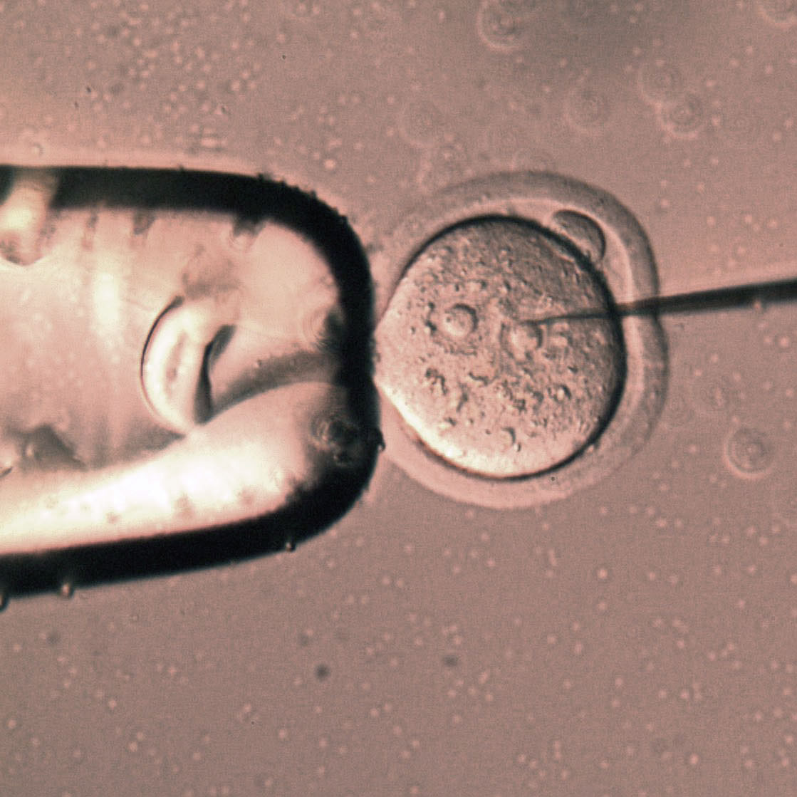 Pronuclear microinjection of fertilized mouse embryo