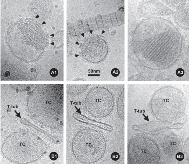 Selected examples of frozen-hydrated isolated TC vesicles and triads Selected examples of frozen-hydrated isolated TC vesicles and triads