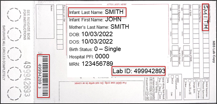 NBS blood collection card