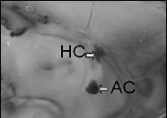 Mid-sagittal view of FVB (left) and BTBR (right) brains, illustrating forebrain commissure differences between the two strains.