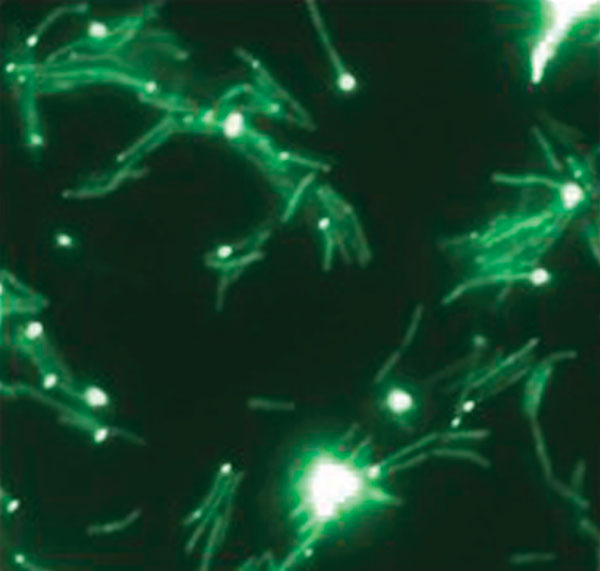 The Esx-1 secretion apparatus is localized to the cell poles of M. smegmatis. When Esx-1 structural proteins from either M. tuberculosis or M. smegmatis are fused to the yellow fluorescent protein, and cells visualized by fluorescence microscopy, the proteins are localized to a cell pole. Thus, the Esx-1 structural apparatus has a unique cellular location. M. smegmatis ESX-1 proteins fused to the yellow fluorescent protein are seen as distinct foci localized to the cell pole.