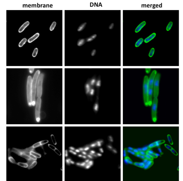 Plague bacilli exhibit a growth defect at host temperatures when the global regulatory gene hfq is deleted (middle panel).