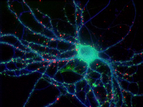 Fixed neuron. Tubulin shown in blue, F-actin in green, presynaptic protein in red. Specimen courtesy of Natalie Dowell-Mesfin