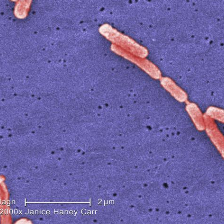 Colorized SEM Legionella. Photo credit: Janice Haney Carr; Content: CDC/Margaret Williams, Claressa Lucas, Tatiana Travis Colorized SEM Legionella. Photo credit: Janice Haney Carr; Content: CDC/Margaret Williams, Claressa Lucas, Tatiana Travis