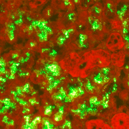 Micrograph in red and green with green showing rabies virus Micrograph in red and green with green showing rabies virus