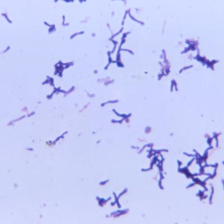 Propionibacterium acnes