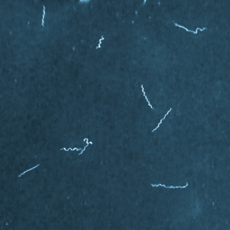 Photo credit: CDC Bacterial Diseases Branch, Fort Collins, CO, Adam Replogle