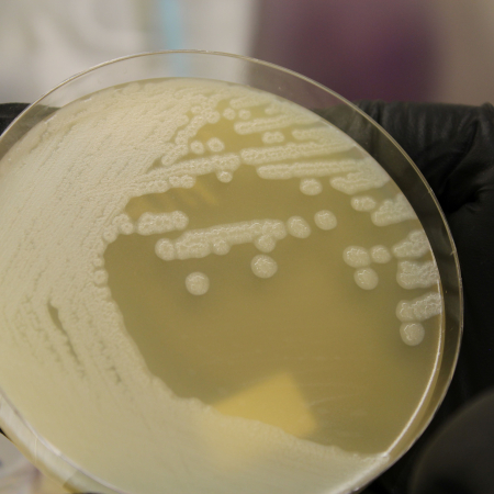 Clostridium botulinum