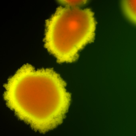Differentiated biofilms of M. abscessus