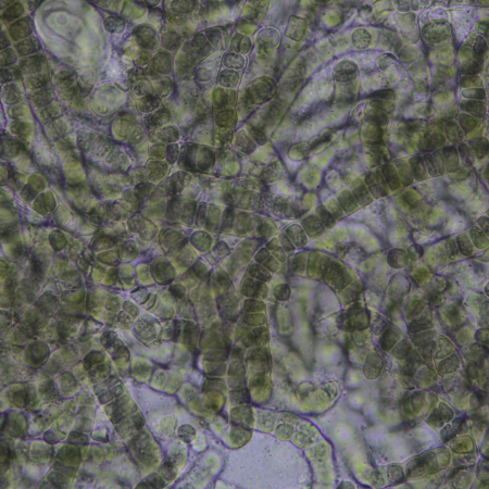 Micrograph of Aetokthonos hydrillicola culture. Photo credit: Chris Tucker.