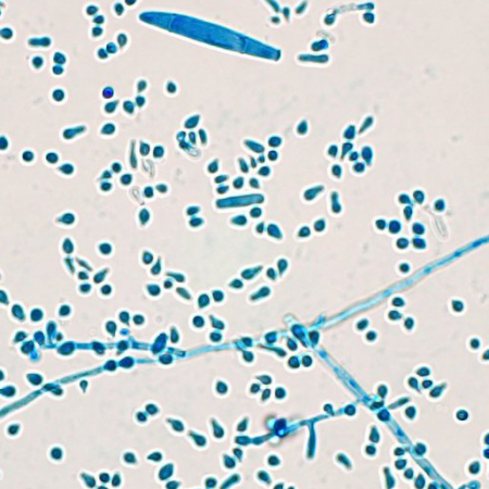 Trichophyton indotineae with macro and micro conidia 