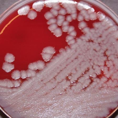 B. anthracis Sterne strain B. anthracis Sterne strain