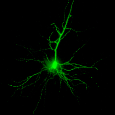 A neonatal rat pyramidal neuron filled with Lucifer Yellow