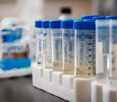 Tubes containing urine specimens