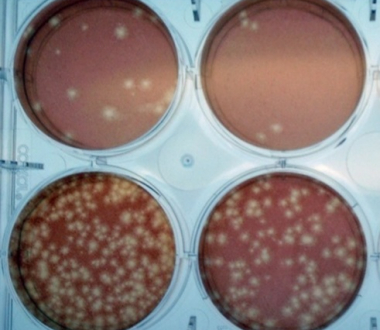 Plaque reduction neutralization test Plaque reduction neutralization test