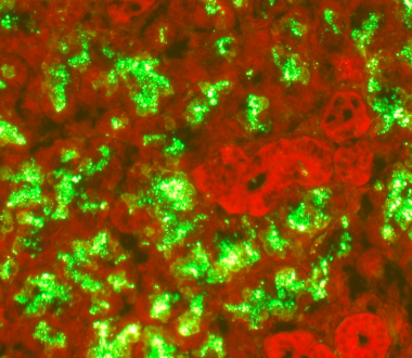 Micrograph in red and green with green showing rabies virus Micrograph in red and green with green showing rabies virus