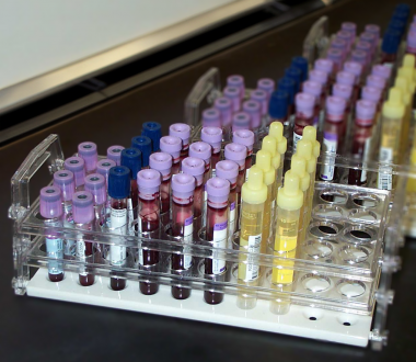 Biomonitoring - tubes containing blood and urine