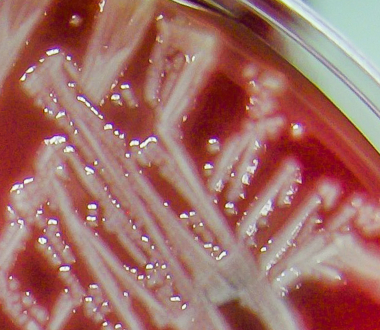 Staphylococcus aureus Staphylococcus aureus