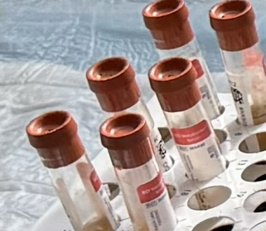 Tubes containing serum for secondhand smoke exposure study