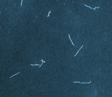 Photo credit: CDC Bacterial Diseases Branch, Fort Collins, CO, Adam Replogle