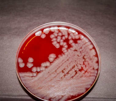 B. anthracis Sterne strain B. anthracis Sterne strain