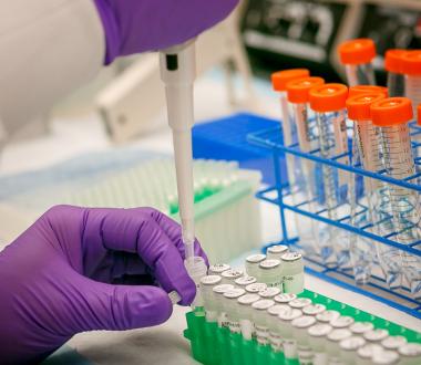 Analysis on water samples received during the NYC South Bronx Legionella investigation. Analysis on water samples received during the NYC South Bronx Legionella investigation.