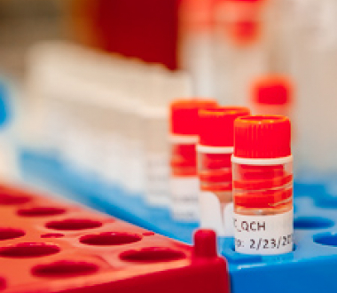 Revised Standards are now available Revised Standards are now available