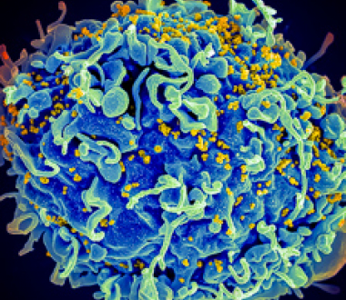 HIV (yellow) attacking T cell. Credit: Seth Pincus, Elizabeth Fischer, Austin Athman, NIAID, NIH HIV (yellow) attacking T cell. Credit: Seth Pincus, Elizabeth Fischer, Austin Athman, NIAID, NIH