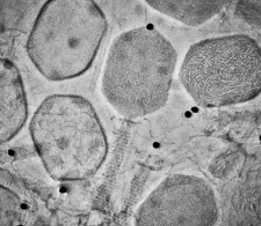 Cryo-TEM image of T4 bacteriophage, vitreously frozen and imaged with phase plate Cryo-TEM image of T4 bacteriophage, vitreously frozen and imaged with phase plate