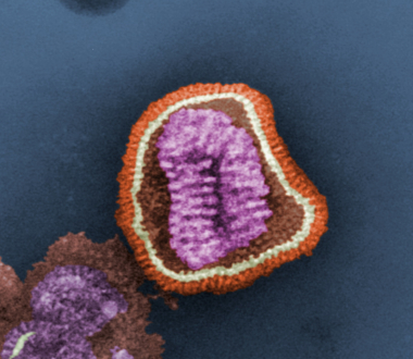 Influenza virus. Photo Credit: Frederick Murphy; Content Provider CDC/Erskine Palmer, Ph.D.; M.L. Martin