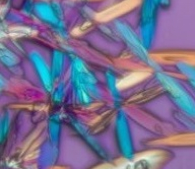 Polarized light image of glucose. Richard Cole, Wadsworth Center Polarized light image of glucose. Richard Cole, Wadsworth Center