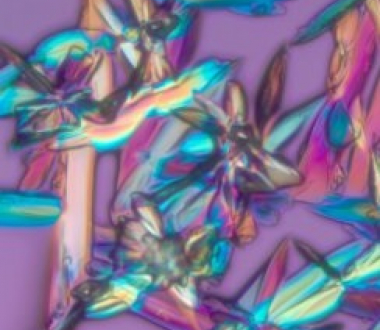 Polarized light image of glucose. Richard Cole, Wadsworth Center Polarized light image of glucose. Richard Cole, Wadsworth Center