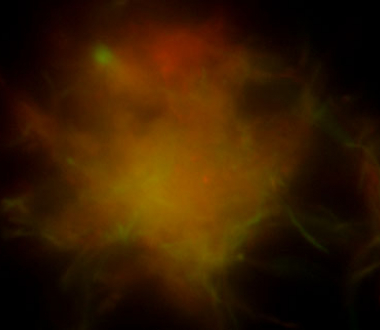 Differential response of mycobacterial biofilms taken by the Ojha Laboratory using a multi-dimensional scope Differential response of mycobacterial biofilms taken by the Ojha Laboratory using a multi-dimensional scope