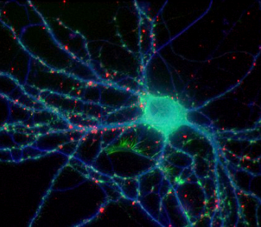 Fixed neuron. Tubulin shown in blue, F-actin in green, presynaptic protein in red. Specimen courtesy of Natalie Dowell-Mesfin