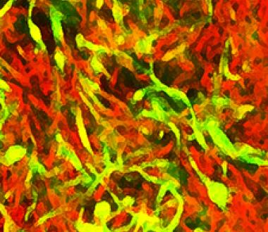 Biofilms of Mycobacterium smegmatis cells - Ojha Laboratory