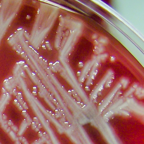 Staphylococcus aureus
