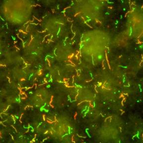 Lyme Disease Bacteria, Borrelia burgdorferi Credit: NIAID, NIH