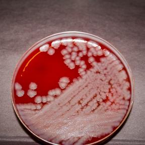 B. anthracis Sterne strain