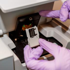 A new screening test for cystic fibrosis will use next generation sequencing.