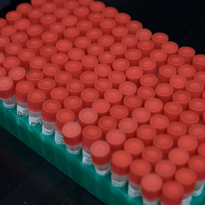 Wadsworth Center Expands National Arbovirus Testing Capacity to Address ...