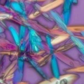 Polarized light image of glucose. Richard Cole, Wadsworth Center