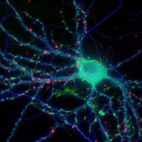 Fixed neuron. Tubulin shown in blue, F-actin in green, presynaptic protein in red. Specimen courtesy of Natalie Dowell-Mesfin